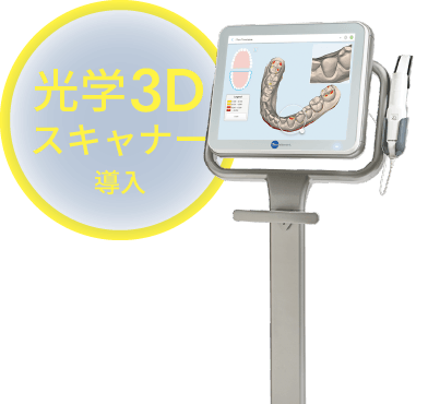 光学3Dスキャナー導入